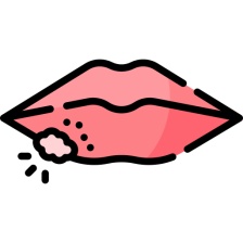  - Afty a herpes