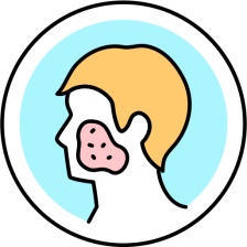  - Rosacea